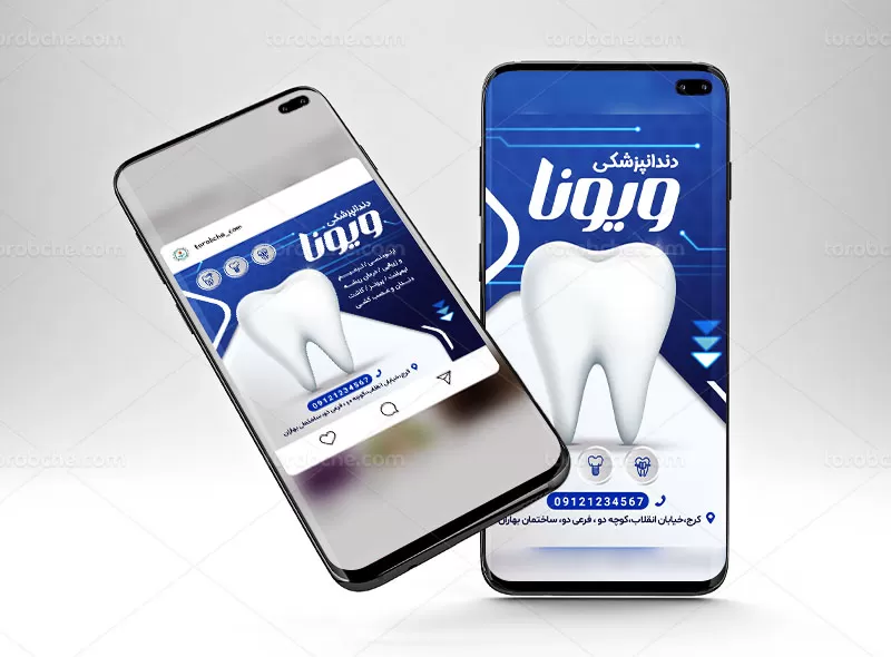طرح بنر و استوری دندانپزشکی
